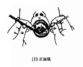 间接鼻咽镜(后鼻镜)检查法