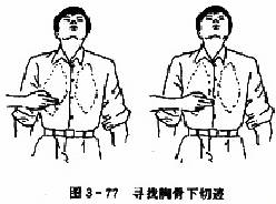 胸外心脏按压术:寻找胸骨下切迹
