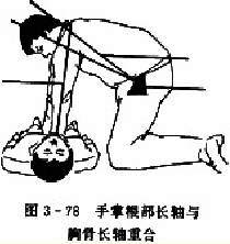 胸外心脏按压术:手掌根部长轴与胸骨长轴重合