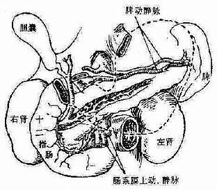 前面观,位于胰腺前面的器官(胃、横结肠及其系膜)已经移除